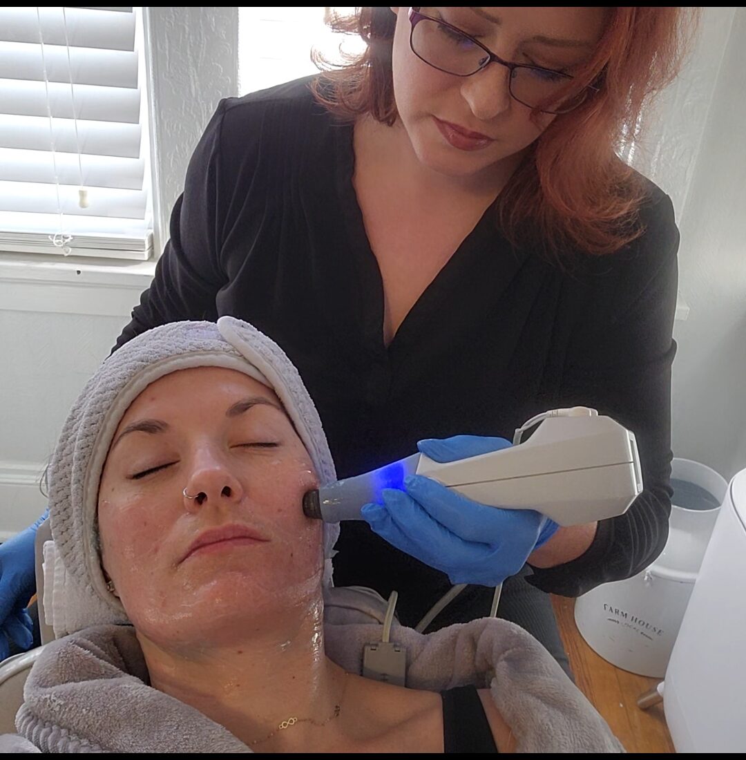 Exilis Face Rejuvenation